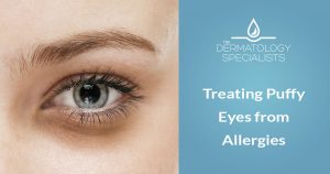 Puffy Eyes - The Dermatology Specialists