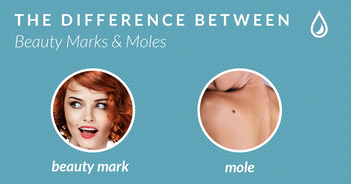 beauty mark vs mole
