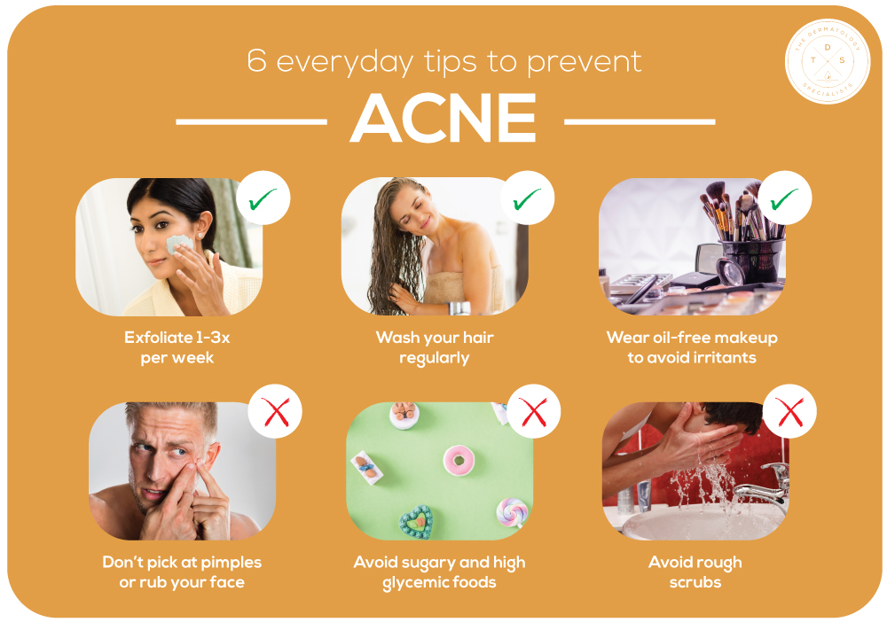 Everyday tips to prevent acne The Dermatology Specialists