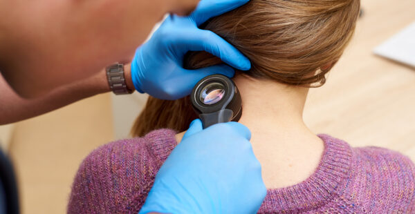 facts about skin cancer from dermatologists